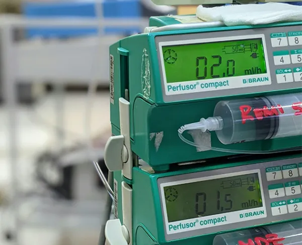 Accurate and controlled drug delivery through advanced infusion pump technology for safe precise and reliable medication administration for ICU step-down post-surgical neonatal oncology palliative chronic illness and critical care patients requiring accurate intravenous drug delivery at home and hospital